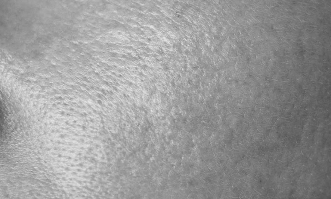 Gezichtsverzorging voor mannen met een vette huid Gezichtsverzorging voor mannen met een vette huid